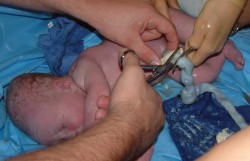 Saving lives... with umbilical cords